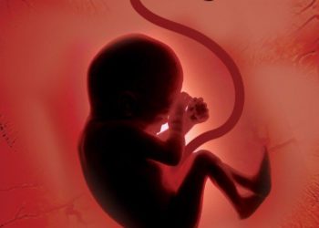 شرایط صدور مجوز سقط