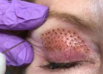 سودجویی آرایشگاه زنانه با دخالت در حوزه پزشکی زیبایی در کرمانشاه