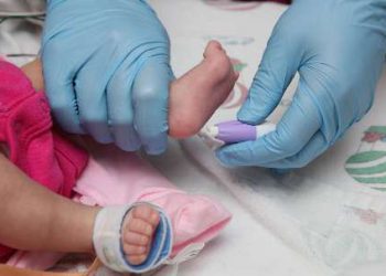 غربالگری بیش از ۴۱۴ هزار نوزاد کردستانی از لحاظ کم کاری تیروئید