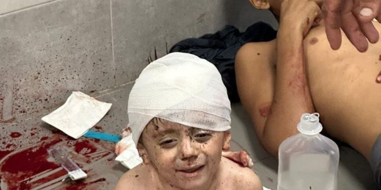 ۵۰۸۷ شهید در ۱۷ روز بمباران غزه/ ۱۵ هزار و ۲۷۳ مجروح