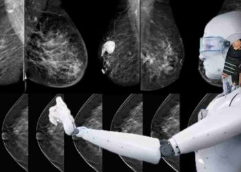 روشی نوین برای تشخیص سرطان پستان با استفاده از هوش مصنوعی