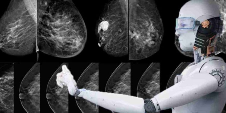 روشی نوین برای تشخیص سرطان پستان با استفاده از هوش مصنوعی