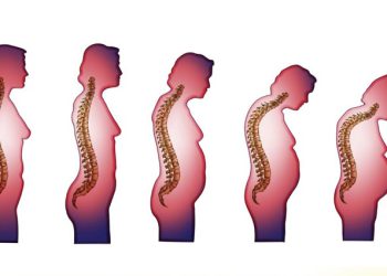 چگونه از کاهش قد در سنین بالا جلوگیری کنیم؟