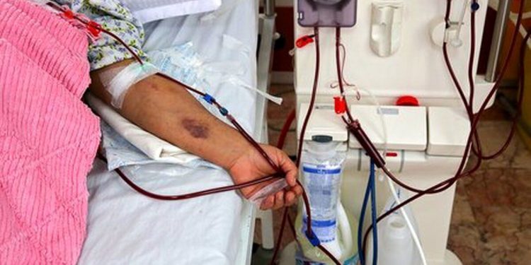 ۷۲۰ بیمار دیالیزی در کرمانشاه وجود دارد/  همه دستگاه‌های دیالیز در استان نیازمند تعمیرات هستند