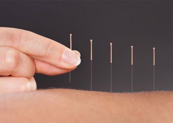 چه بیماری‌هایی به کمک طب سوزنی بهبود می یابند؟