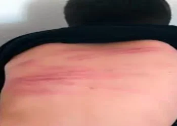 دانش آموز سنندجی توسط معلم کتک کاری و راهی بیمارستان شد