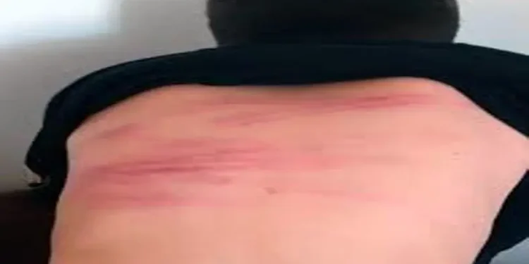 دانش آموز سنندجی توسط معلم کتک کاری و راهی بیمارستان شد