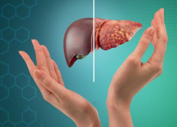 کدام ویتامین در درمان کبد چرب اثرگذار است؟