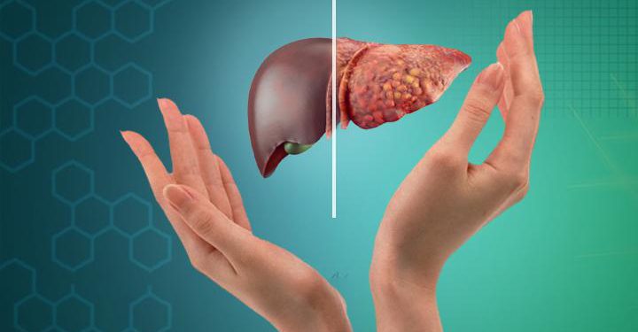 کدام ویتامین در درمان کبد چرب اثرگذار است؟