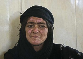 ساڵیادی بۆردومانی کیمیایی گوندی زەردەی کرماشان