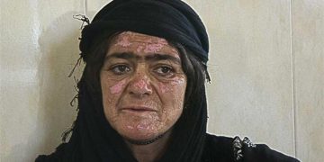 ساڵیادی بۆردومانی کیمیایی گوندی زەردەی کرماشان