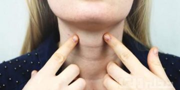 نیشانەکانی کەمی یۆد لە جەستەدا بزانە