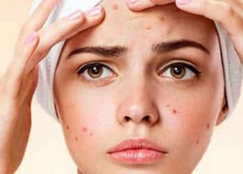 بۆ نەمانی زیپکەی ڕوخسار لە چەند خواردنێک دوور بکەرەوە