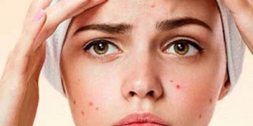 بۆ نەمانی زیپکەی ڕوخسار لە چەند خواردنێک دوور بکەرەوە