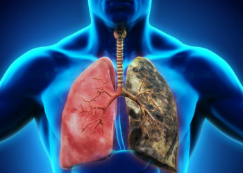 هۆکارە کاریگەرەکانی توشبوون بە شێرپەنجەی سییەکان