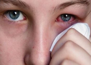 بۆ چاو سور دەبێتەوە؟