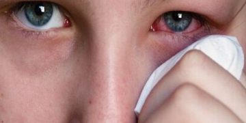 بۆ چاو سور دەبێتەوە؟