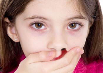 چی لە سەر خوێن بەربوونی لووت دەزانین؟