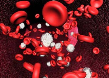 چۆن کەمی ئاسن لە جەستەدا چارەسەر بکەین؟