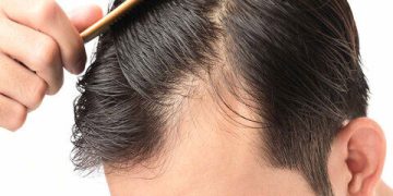 چەند ڕێکارێکی سادە بۆ ڕێگری لە هەڵوەرینی قژ