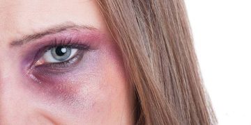 بۆ ژێری چاو ڕەش دەبێتەوە؟