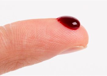 نیشانەکانی خەستبوونی خوێن