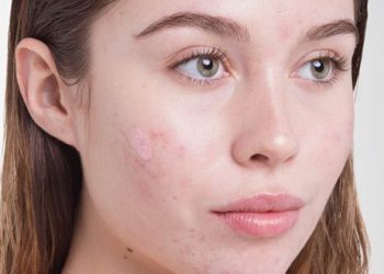 چەند ڕێگایەک بۆ چارەسەرکردنی زیپکە