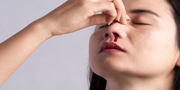 هۆکارەکانی خوێنبەربوونی لوت چییە؟