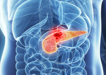 چەند ڕێگایەکی چارەسەرکردنی هەوکردنی پەنکریاس