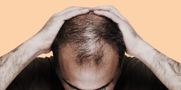 چەند خۆراکێک کە دەبنە هۆکاری ڕوتانەوەی قژی پیاوان