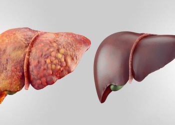 چۆن بزانین تووشی نەخۆشیی جگەر بووین؟