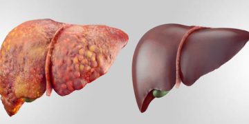 چۆن بزانین تووشی نەخۆشیی جگەر بووین؟