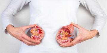 کێن ئەوانەی مەترسی توشبوونیان بە نەخۆشی سستبوونی گورچیلە لە سەرە؟