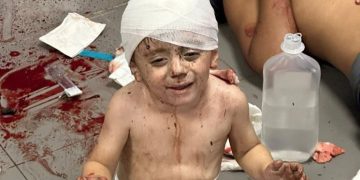 هێرشی دڕندانەی ڕژێمی زایۆنیستی بۆ سەر نەخۆشخانەیەکی غەززە