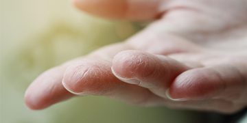 چۆن لە وشکبوونەوەی جەستە ئاگادار بین؟