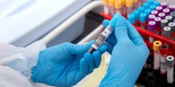 ئەو پشکنینانەی بۆ هەموو کەسێک بە پێویست دادەنرێت