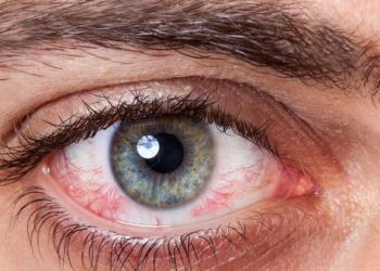 چۆن تەندرووستی چاو باشتر بکەین؟