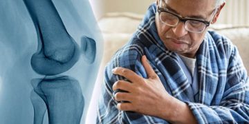 چی لە سەر شێرپەنجەی ئێسک دەزانین؟