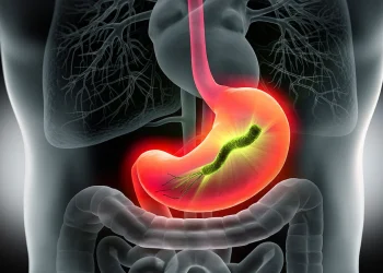 لە کاتی هەوکردنی گەدەدا چ خۆراکێک بەکار بهێنین؟