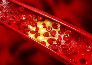 مەترسییە شاراوەکانی بەرزبوونەوەی چەوری خوێن و ڕێگەی سرووشتی بۆ چارەسەرکردنی