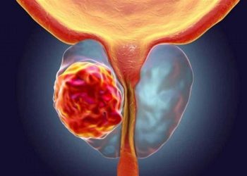 نیشانەکانی گەورەبوونی پرۆستات و چارەسەرکردنی لە ماڵەوە