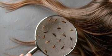 لە گواستنەوەوە تا چارەسەری مێشوولەی سەر