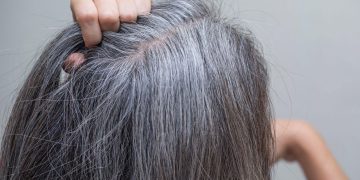 هۆکارەکانی سپیبونەوەی قژ و ڕێگای چارەسەرکردنی