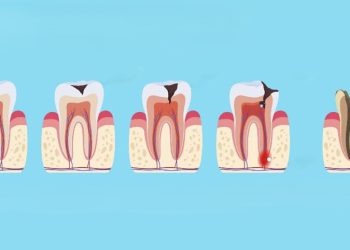 ئەم ڤیتامینانە هۆکارێکن بۆ تەندرووستی ددانت