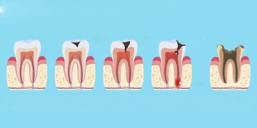 ئەم ڤیتامینانە هۆکارێکن بۆ تەندرووستی ددانت