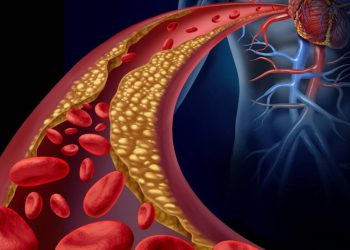 چەند ڕێگایەکی گرنگ بۆ دابەزاندنی کۆلیسترۆل خوێن