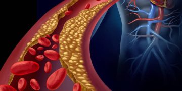 چەند ڕێگایەکی گرنگ بۆ دابەزاندنی کۆلیسترۆل خوێن